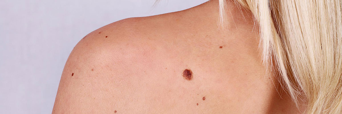 Cuide bem da sua pele