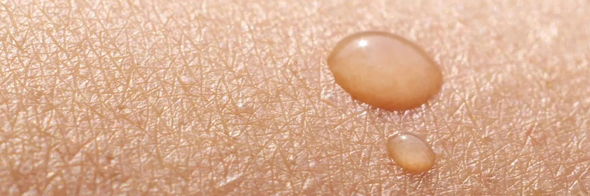 Mantenha a saúde do seu manto protetor